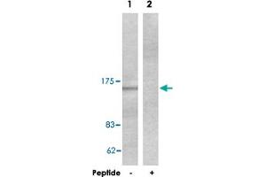 Western blot analysis of extracts from HeLa cells, using COL4A1 polyclonal antibody . (COL4A1 anticorps  (AA 31-70))