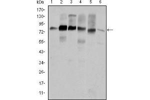 Western blot analysis using CTTN mouse mAb against Hela (1), A431 (2), MCF-7 (3), SR-BR-3 (4), HepG2 (5) and NIH/3T3 (6) cell lysate. (Cortactin anticorps)