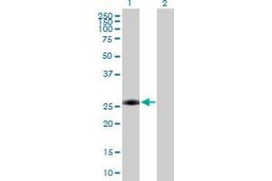 Western Blot analysis of AAAS expression in transfected 293T cell line by AAAS MaxPab polyclonal antibody.