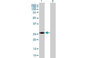 Western Blot analysis of AAAS expression in transfected 293T cell line by AAAS MaxPab polyclonal antibody.