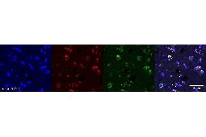 Immunohistochemistry (IHC) image for anti-Oligodendrocytic Myelin Paranodal and Inner Loop Protein (OPALIN) antibody (ABIN7456142) (OPALIN anticorps)