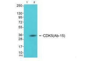 Western blot analysis of extracts from cos-7 cells (Lane 2), using CDK5 (Ab-15) antiobdy. (CDK5 anticorps  (Tyr15))