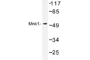 Image no. 1 for anti-MAP Kinase Interacting serine/threonine Kinase 1 (MKNK1) antibody (ABIN272252) (MKNK1 anticorps)