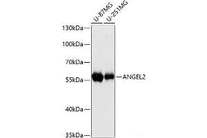 Western blot analysis of extracts of various cell lines using ANGEL2 Polyclonal Antibody at dilution of 1:3000. (ANGEL2 anticorps)