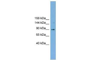 TACC3 antibody used at 1 ug/ml to detect target protein. (TACC3 anticorps  (Middle Region))