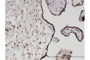 anti-Tripartite Motif Containing 21 (TRIM21) (AA 1-475) antibody
