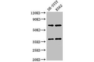Western Blot Positive WB detected in: SH-SY5Y whole cell lysate, K562 whole cell lysate All lanes: CTSH antibody at 2.