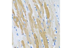 Immunohistochemistry of paraffin-embedded rat heart using WFDC2 antibody at dilution of 1:100 (40x lens). (WFDC2 anticorps)