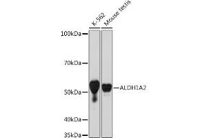 Western blot analysis of extracts of various cell lines, using  Rabbit mAb (ABIN7265532) at 1:1000 dilution.