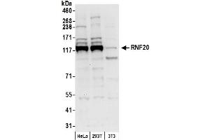 Western Blotting (WB) image for anti-Ring Finger Protein 20 (RNF20) (AA 1-50) antibody (ABIN7450665)