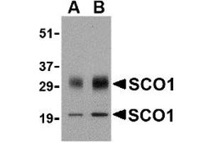 Western Blotting (WB) image for anti-SCO1 Cytochrome C Oxidase Assembly Protein (SCO1) (Middle Region) antibody (ABIN1031080) (SCO1 anticorps  (Middle Region))