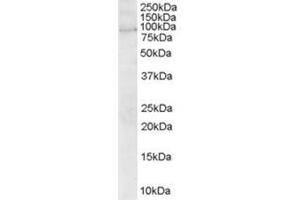 Image no. 1 for anti-rho Guanine Nucleotide Exchange Factor (GEF) 4 (ARHGEF4) (N-Term) antibody (ABIN374361) (ARHGEF4 anticorps  (N-Term))