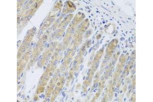 Immunohistochemistry of paraffin-embedded Mouse stomach using RARS2 Polyclonal Antibody at dilution of 1:100 (40x lens). (RARS2 anticorps)