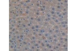 Used in DAB staining on fromalin fixed paraffin- embedded Kidney tissue