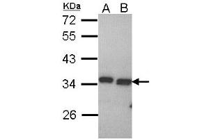 Western Blotting (WB) image for anti-Peroxisomal Trans-2-Enoyl-CoA Reductase (PECR) (AA 241-302) antibody (ABIN467560)