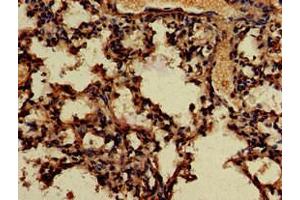 Immunohistochemistry of paraffin-embedded human lung tissue using ABIN7166683 at dilution of 1:100 (APOBEC4 anticorps  (AA 221-367))