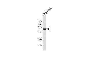 Anti-T Antibody (Center) at 1:2000 dilution + Rat plasma whole lysate Lysates/proteins at 20 μg per lane. (PLAT anticorps  (AA 371-399))