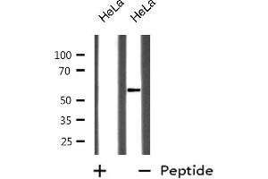 Western blot analysis of GABA-RB expression in HeLa whole cell lysates,The lane on the left is treated with the antigen-specific peptide. (GABA-RB anticorps)