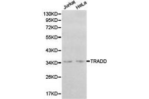 Western Blotting (WB) image for anti-TNFRSF1A-Associated Via Death Domain (TRADD) antibody (ABIN1875189) (TRADD anticorps)