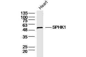 Mouse heart lysates probed with SPHK1 Polyclonal Antibody, unconjugated  at 1:30 overnight at 4°C followed by a conjugated secondary antibody at 1:10000 for 90 minutes at 37°C.
