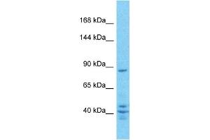Host:  Rabbit  Target Name:  ZN160  Sample Type:  PANC1 Whole Cell lysates  Antibody Dilution:  1. (ZNF160 anticorps  (C-Term))