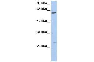 FAM3C antibody used at 1 ug/ml to detect target protein. (FAM3C anticorps  (C-Term))