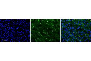 Rabbit Anti-ADCK2 Antibody  Catalog Number: ARP63131_P050 Formalin Fixed Paraffin Embedded Tissue: Human Adult Liver  Observed Staining: Membrane in bile canaliculi, strong signal, wide tissue distribution Primary Antibody Concentration: 1:100 Secondary Antibody: donkey anti-rabbit FITC Secondary Antibody Concentration: 1:200 Magnification: 20X Exposure Time: 0. (ADCK2 anticorps  (Middle Region))