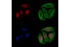 ABIN6254904 and ABIN6267568 staining Hela cells by IF/ICC. (Histone 3 anticorps  (H3K9ac))