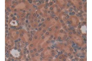 Detection of IL22Ra2 in Rat Kidney Tissue using Polyclonal Antibody to Interleukin 22 Receptor Alpha 2 (IL22Ra2)