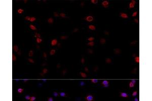 Immunofluorescence analysis of PC-12 cells using ATP5B Polyclonal Antibody at dilution of 1:100 (40x lens).
