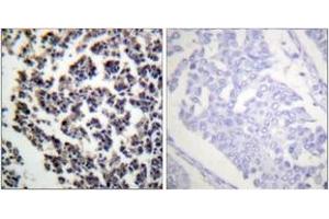 Immunohistochemistry analysis of paraffin-embedded human lymph node, using BLNK (Phospho-Tyr96) Antibody.