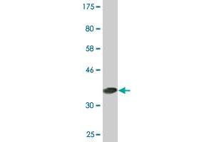 Western Blot detection against Immunogen (37. (PCTP anticorps  (AA 106-214))
