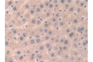 Detection of UBD in Rat Liver Tissue using Polyclonal Antibody to Ubiquitin D (UBD) (UBD anticorps  (AA 1-155))