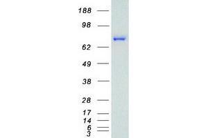 Validation with Western Blot
