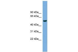 WB Suggested Anti-TMPRSS4 Antibody Titration:  0. (TMPRSS4 anticorps  (N-Term))