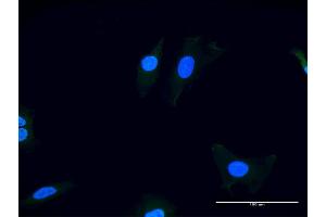 Immunofluorescence of purified MaxPab antibody to ITGAV on HeLa cell. (CD51 anticorps  (AA 1-1048))