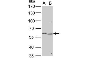 WB Image GALNS antibody detects GALNS protein by Western blot analysis.