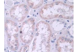 IHC-P analysis of Human Kidney Tissue, with DAB staining. (TRPC6 anticorps  (AA 1-192))