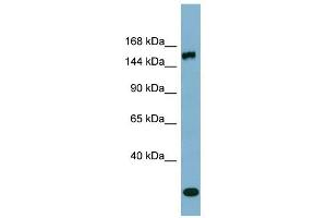 EPRS antibody used at 1 ug/ml to detect target protein. (EPRS anticorps  (Middle Region))