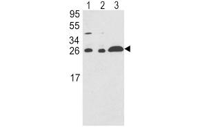 Western Blotting (WB) image for anti-rho GDP Dissociation Inhibitor (GDI) alpha (ARHGDIA) antibody (ABIN3001701) (ARHGDIA anticorps)