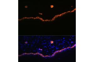 Immunofluorescence analysis of rat skin using Cytokeratin 15 (KRT15) (KRT15) Rabbit mAb (ABIN7268093) at dilution of 1:100 (40x lens).