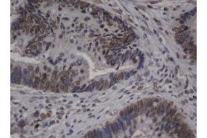 Image no. 1 for anti-Jun Proto-Oncogene (JUN) antibody (ABIN1498940)
