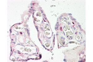 KERA 抗体  (AA 196-245)