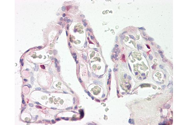 KERA Antikörper  (AA 196-245)