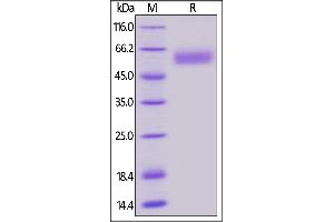 Biotinylated Human BTLA (31-150), Fc,Avitag on  under reducing (R) condition.