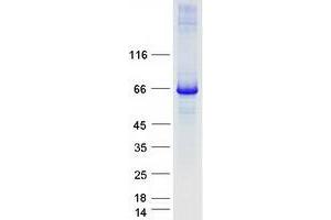 Validation with Western Blot