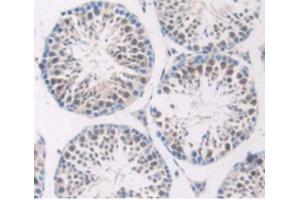IHC-P analysis of Mouse Testis Tissue, with DAB staining. (SERPING1 anticorps  (AA 397-495))