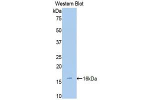 Western blot analysis of the recombinant protein.