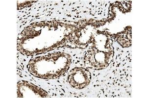 IHC analysis of TET1 using anti TET1 antibody (ABIN7600442). (TET1 anticorps  (AA 194-417))