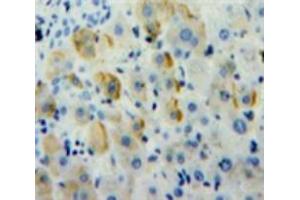 Used in DAB staining on fromalin fixed paraffin-embedded Liver tissue (alpha 1 Adrenergic Receptor anticorps  (AA 330-466))